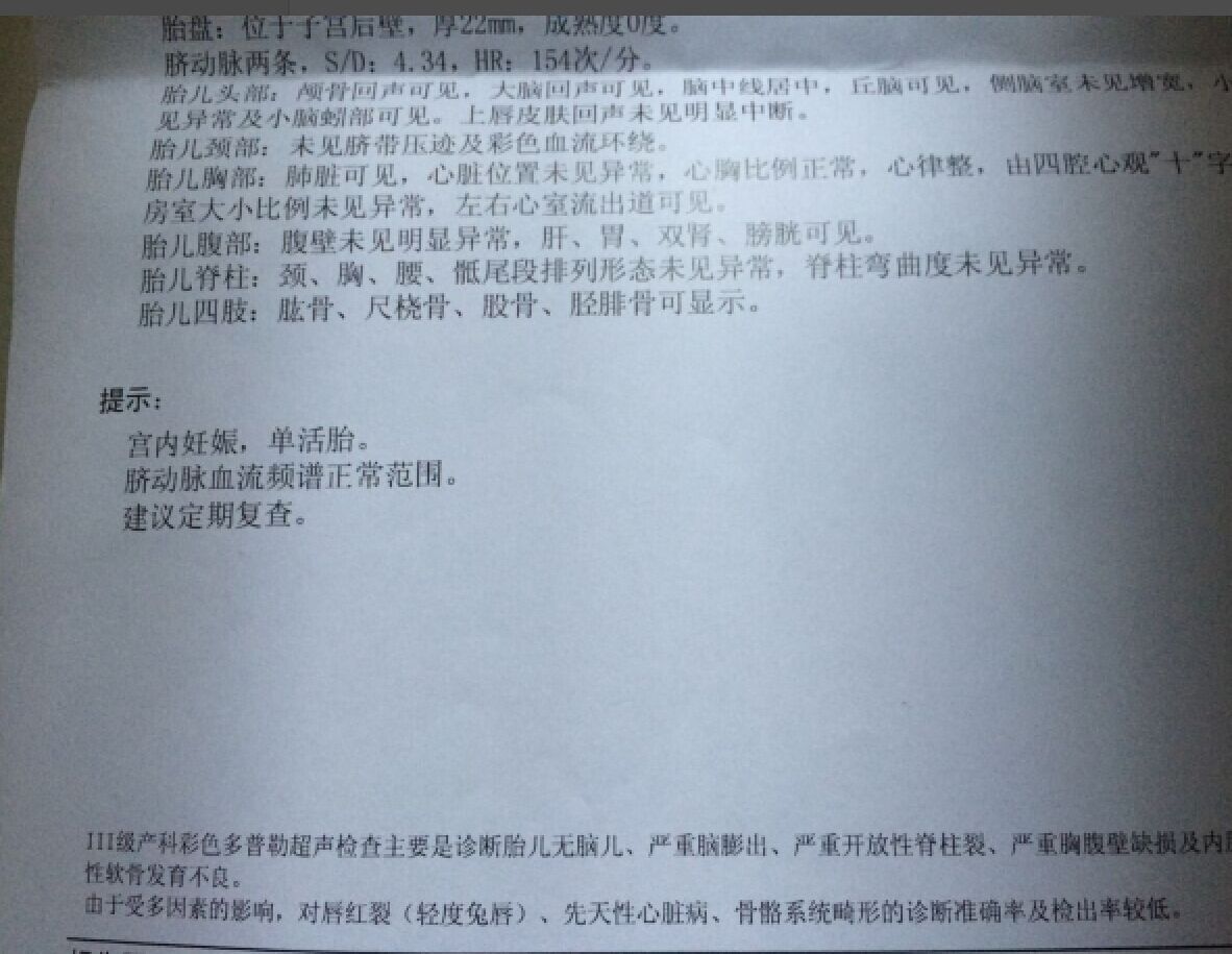 QQͼƬ20170217115434.jpg